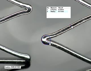 Image HDR de l’entretoise d’un stent et mesure du rayon de courbure (150x)