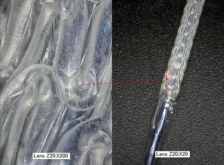 Images sous grossissement d’un stent biorésorbable (gauche : 200x/droite : 20x)
