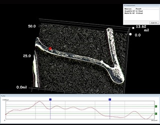 Mesures de forme 3D et de profil d’un stent biorésorbable